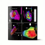 Cardiothoracic Surgery 2nd Ed eBook by CRC Press Kindle Replica-0