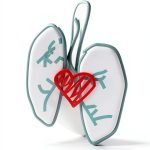 Cardiothoracic Surgery Kindle Book by XYZ Press 360 Page Medical-0