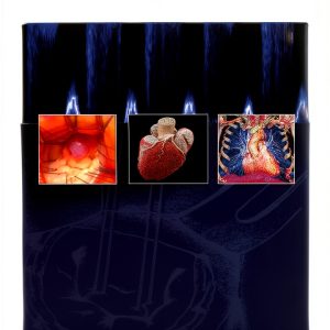 Thoracic Surgery Handbook 2nd Edition by tfm Publishing Kindle eBook-0